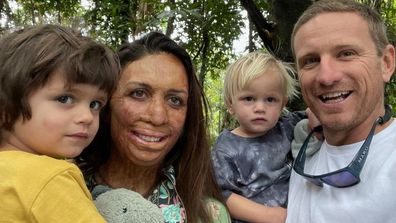 Turia Pitt and her partner Michael have you two young sons together.