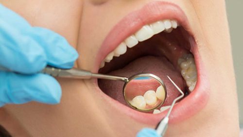 Woman dentist teeth clean check-up