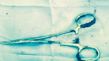 The rusted scissors after they were removed from Ma Van Nha's stomach.