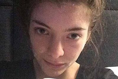 She was into the "no makeup selfie" before it was cool.<br/><br/>@lordemusic: "in bed in paris with my acne cream on"<br/>