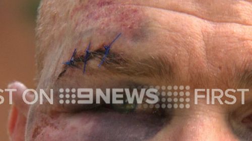 For legal reasons the man cannot be named. (9NEWS)