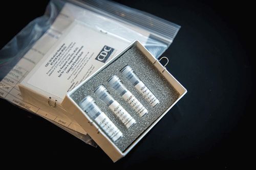 This undated photo provided by U.. Centres for Disease Control and Prevention shows CDCs laboratory test kit for the new coronavirus. (CDC via AP)