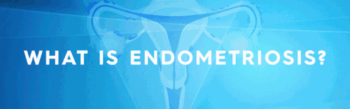 Cosa viene spiegato GIF endometriosi