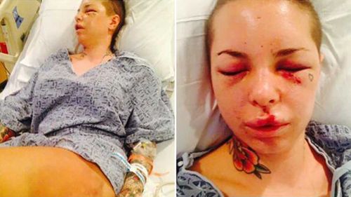 Christy Mack's injuries are plainly visible in hospital. (Twitter)