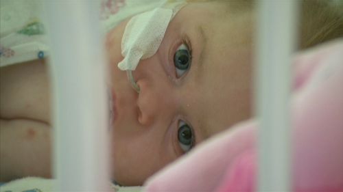 Eight-month-old Tahlea was diagnosed with Meningoccal six weeks ago after her mother Chelsea Cocking woke to find her struggling to breathe.