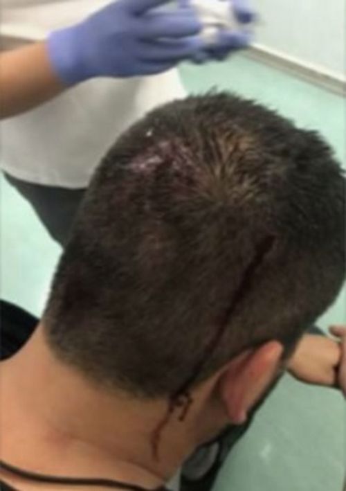 A picture taken by one passenger shows the back of a man's head, dripping with blood, allegedly after one of the violent clashes (3AW).