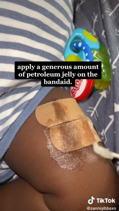 Mum reveals 'amazing' hack for removing bandaids painlessly.