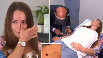 Mum may have escaped deadly melanoma thanks to strangers