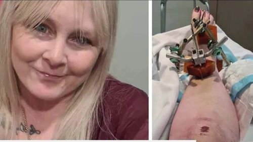 Shepparton grandmother Rebekah Streader has had two surgeries this week after being left with a shattered foot in a Facebook Marketplace sale gone wrong.