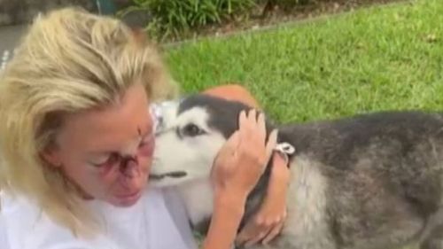 Paul foi submetido a uma cirurgia hoje devido a um nariz quebrado após o ataque.