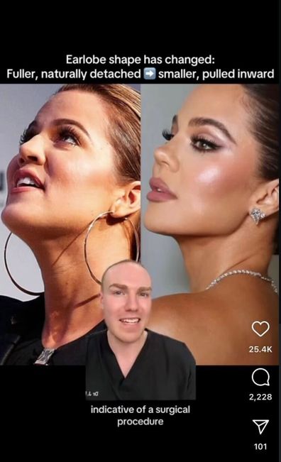 Dr. Jonny Betteridge on Khloe Kardashian