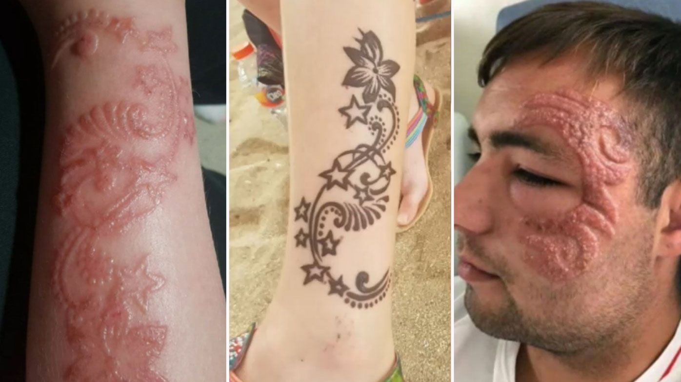 Dangerous black henna  tattoos  leaving Bali  tourists with 