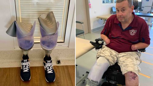 Jason 'Buddy' Miller with his new prosthetic legs.