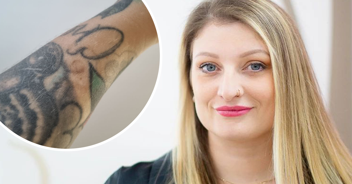 Nipple tattoos Australia: Touching reason Nicole Prance has a tiny nipple tattooed on her arm - 9Honey