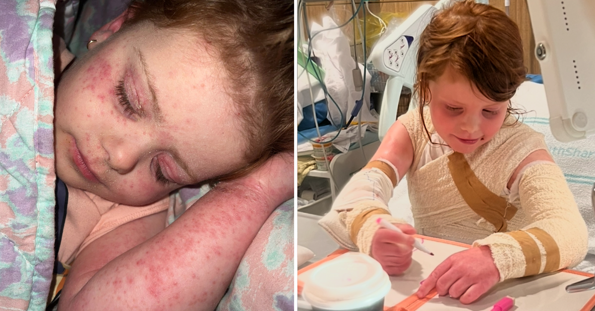 Family among thousands priced out of life-changing medication