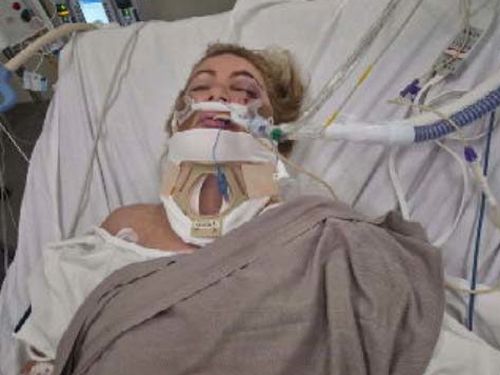 Tania Kerr was was left for dead with head injuries after being hit coming home from a friend's place.