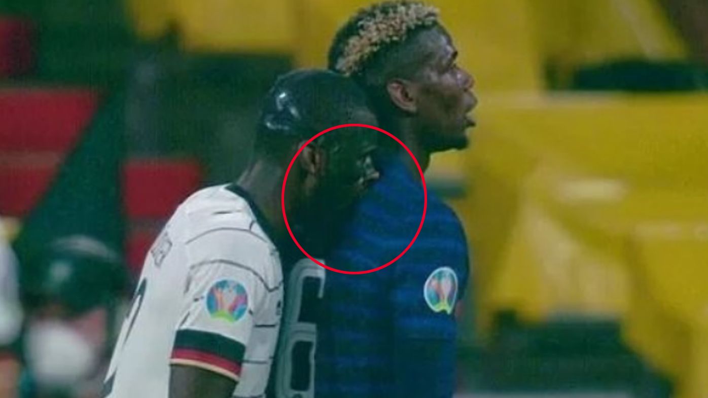 Pogba appears to be bitten