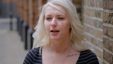 Hannah has severe skin condition on Embarrassing Bodies on 9Now
