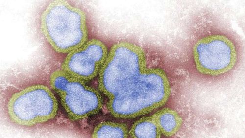 Influenza A is a particularly nasty virus that spreads across Australia.
