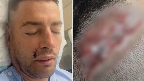 Father-of-two Andreas Lehr was attacked by a stranger after singer Luke Combs' concert outside RAC Arena on Saturday night.