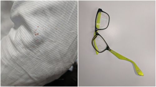 The 30-year-old office worker was left with broken glasses and a bloodied shirt following the ordeal. Picture: 9NEWS