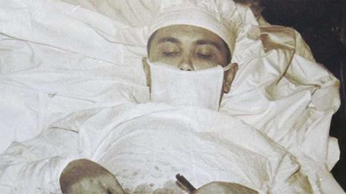Leonid Rogozov had no choice but to cut out his own appendix.
