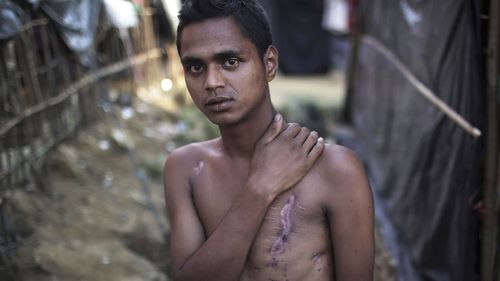 Mohammadul Hassan, 18,  outside his family's tent in Jamtoli refugee camp in Bangladesh. Hassan still bears the scars on his chest and back from being shot by soldiers who attempted to kill him. (AAP)