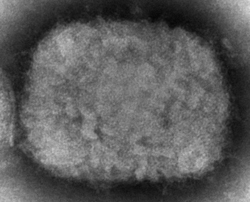 This 2003 electron microscope image made available by the Centers for Disease Control and Prevention shows a monkeypox virion, obtained from a sample associated with the 2003 prairie dog outbreak.  Monkeypox, a disease that rarely appears outside Africa, has been identified by European and American health authorities in recent days.  (Cynthia S. Goldsmith, Russell Regner / CDC via AP)