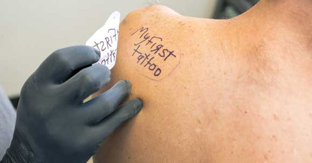 Safe, painless tattoo removal cream in works