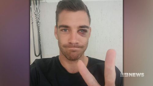 Cam Cranley was attacked in a one punch assault on a night out. (9NEWS)