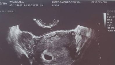 Amanda Bynes, ultrasound, pregnant, Instagram, post