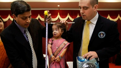 Jyoti Amge has primordial dwarfism, a rare genetic condition.