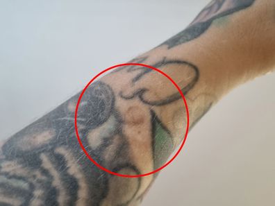 The nipple tattooed on Nicole Prance's arm in eyebrow ink has faded, but it's still visible.
