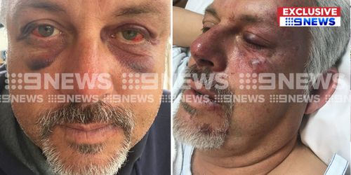 Brian spent the night in hospital after the incident. (9NEWS)