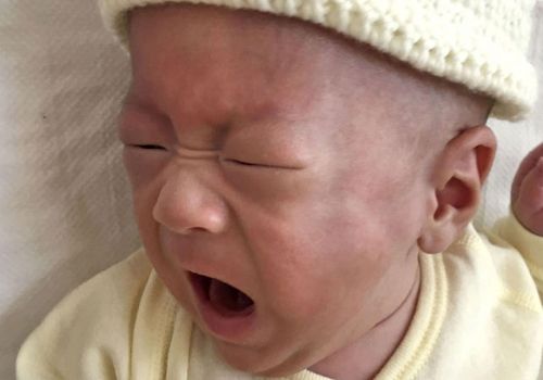 The baby boy is now more than 12 times his birth weight. (Photo: Keio University Hospital)