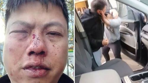 Melbourne father Tony Bui has been attacked after he confronted a man who allegedly stole his new car from his driveway. Tony Bui brought his brand new Kia Carnival home to his Footscray property on Friday afternoon. 