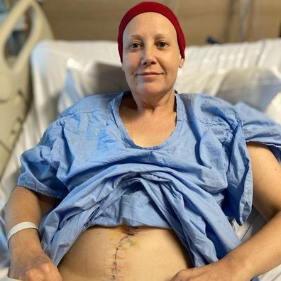 Siobhan O'Sullivan shows the scar from one of the surgeries she underwent for ovarian cancer.