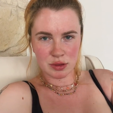 Ireland Baldwin opens up about her abortion story on TikTok, in wake of Roe v. Wade repeal.