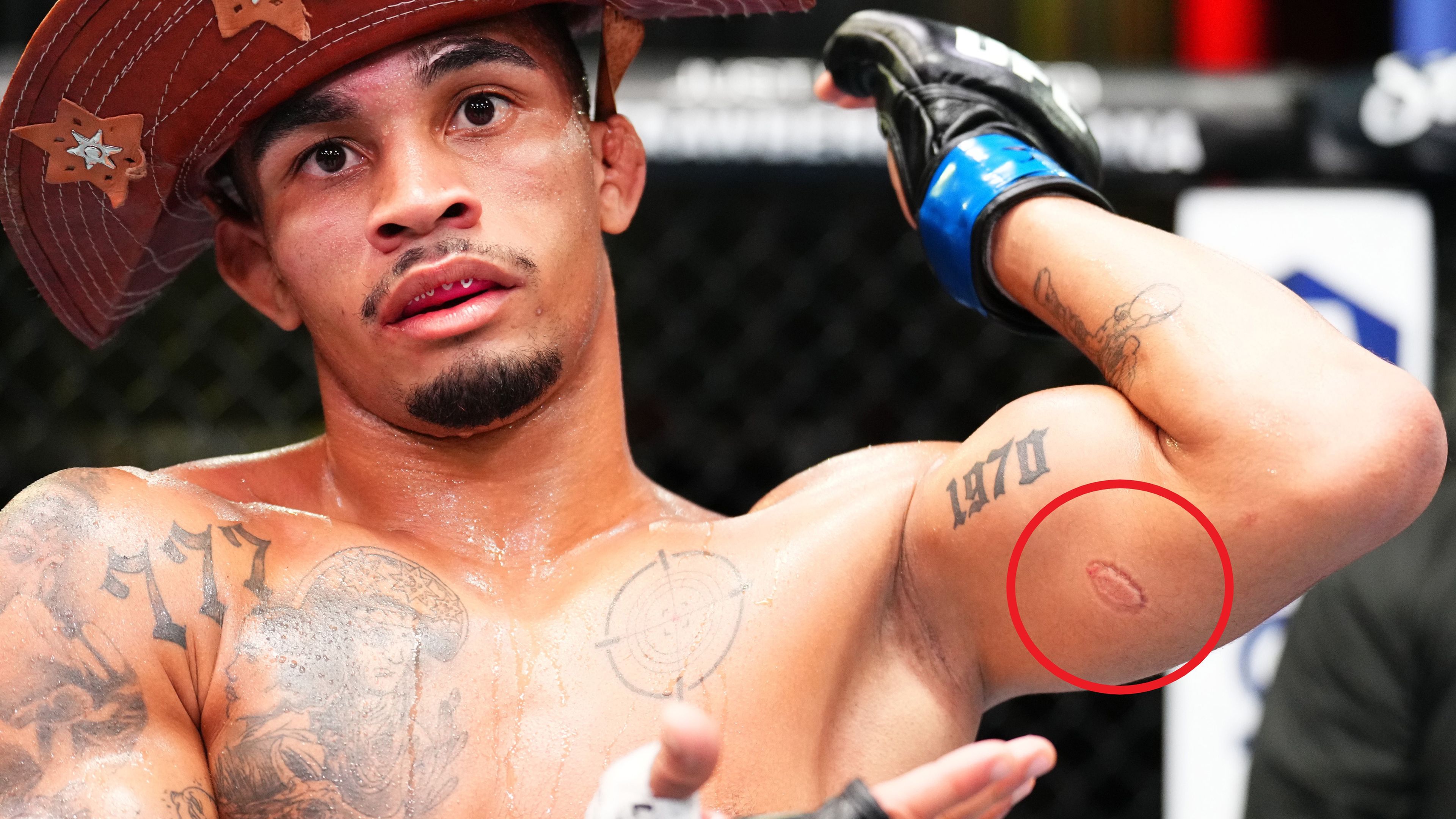 'Cut this weirdo': UFC fighter Igor Severino set to be axed following 'nasty' biting incident