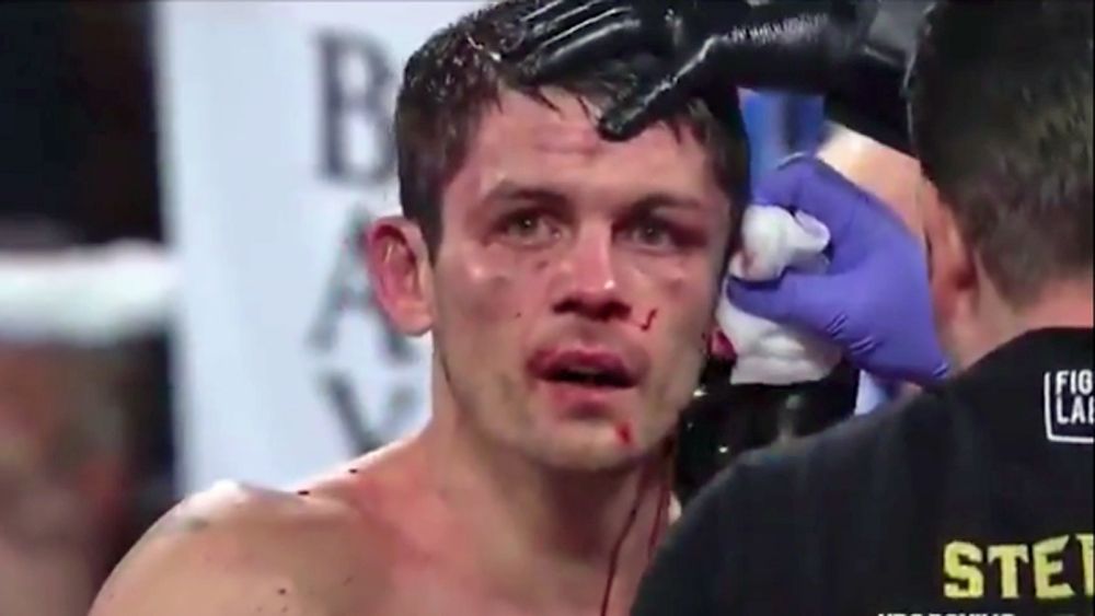 Boxing: Stephen Smith suffers horrific ear injury in bout against Francisco Vargas