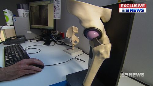 Tens of thousands of Australians who have had a hip replacement currently may be at risk of lesions. (9NEWS)