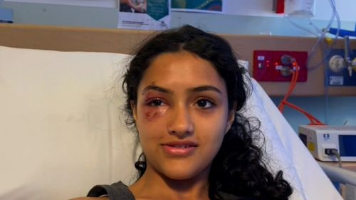 A 13-year-old has recalled the moment she was struck by a car that then allegedly drove off, leaving her lying injured on a road in north-west Adelaide.