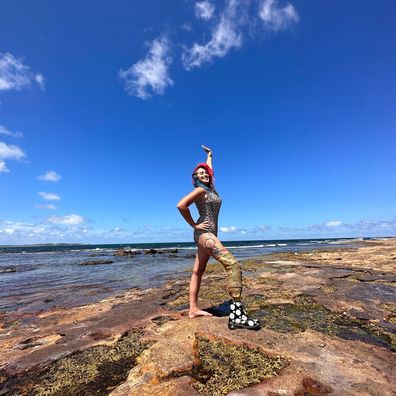 Lucy Woolfman poses at the beach with her prosthetic leg.