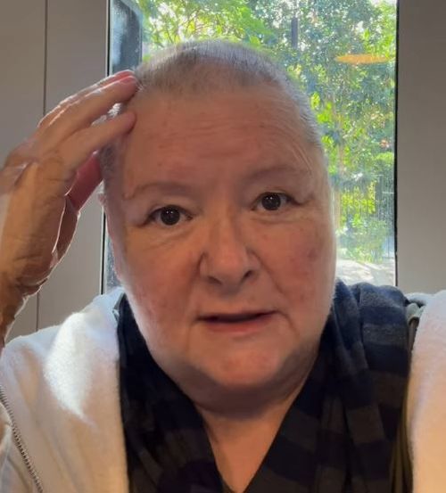 Magda Szubanski reveals she has a cancer 