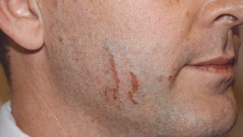 Scratches on Gerard Baden-Clay's face were discussed in court. (AAP)