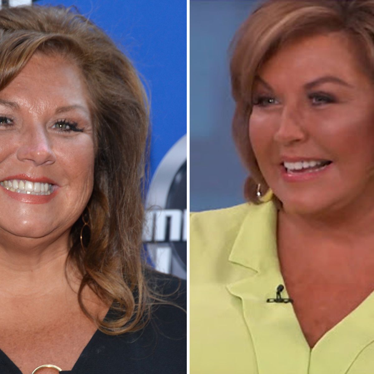 Abby Lee Miller Reveals Facelift Results