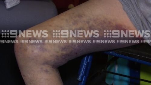 The great-grandfather suffered a fractured back and bruised leg. (9NEWS)