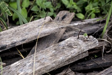 An unvaccinated child nearly died from tetanus 