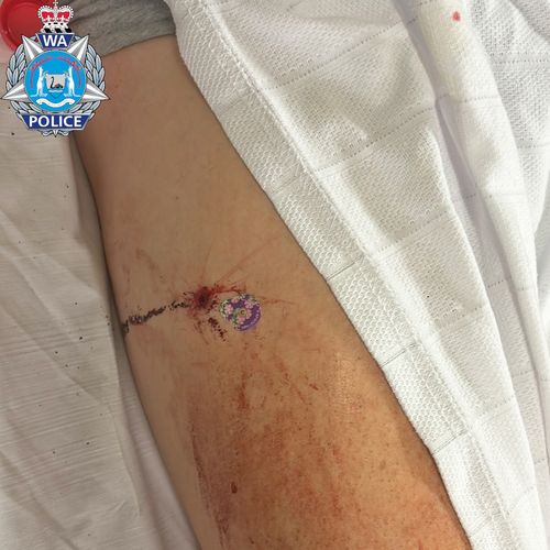 WA Police released some images showing the extent of the man's injuries.