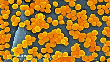 Methicillin Resistant Golden Staph Staphylococcus Aureus Mrsa